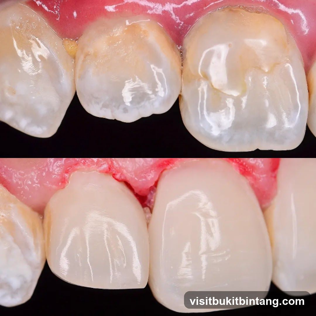 Dental Restoration Comparison