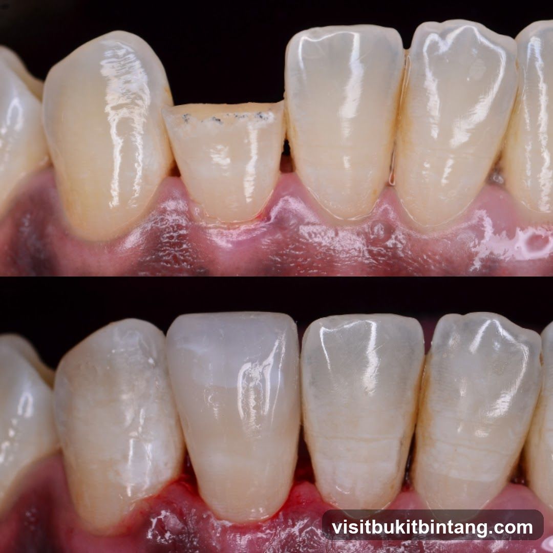 Dental Restoration Comparison