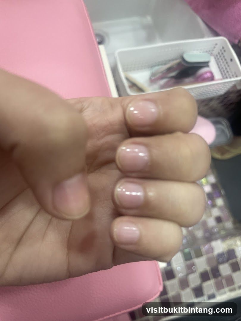 Nail Care