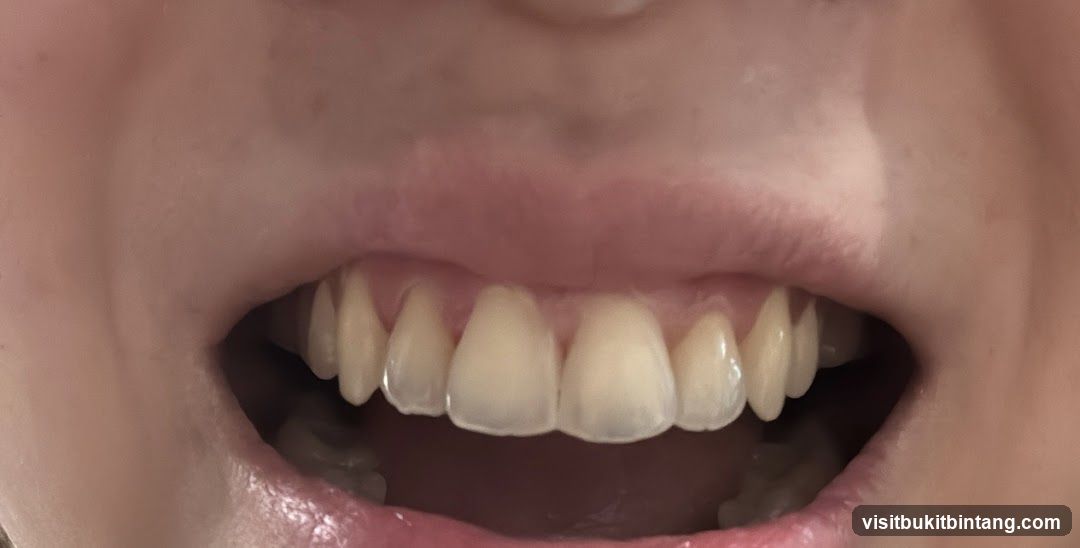 Smile Avenue Dental Surgery Publika | 15 Years Experience Dentist