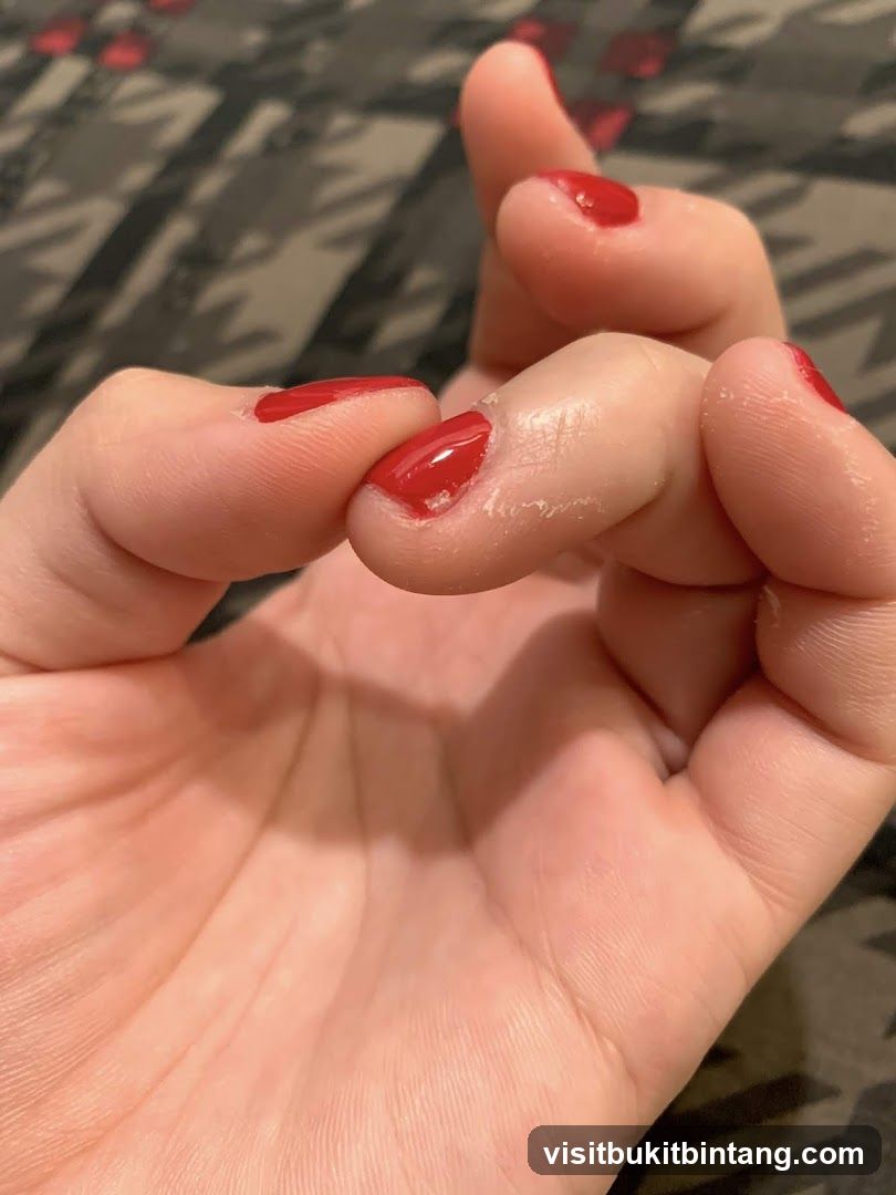 Hand with red nail polish showing skin condition