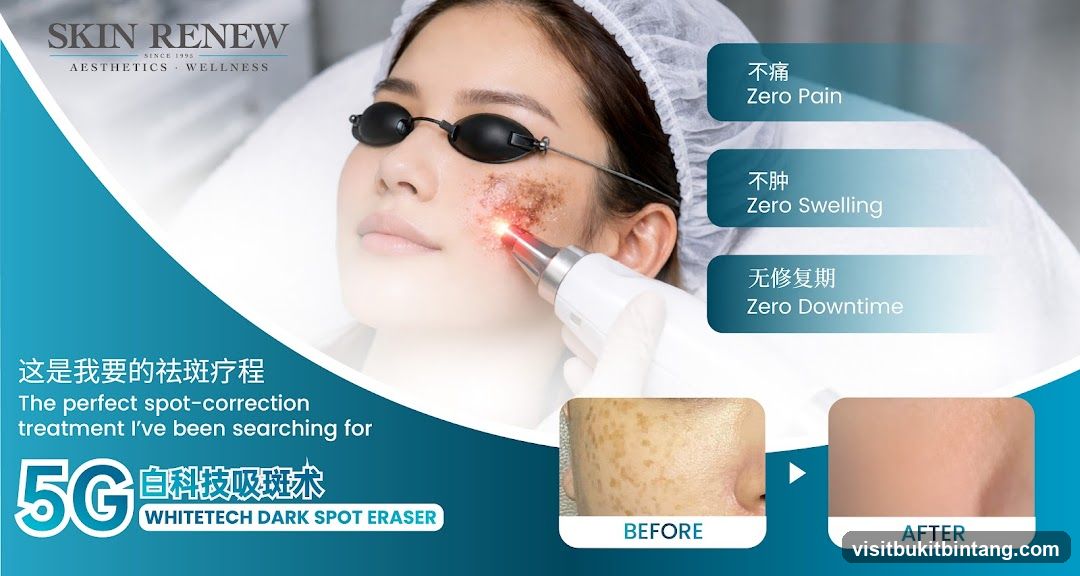 Skin Renew Advertisement