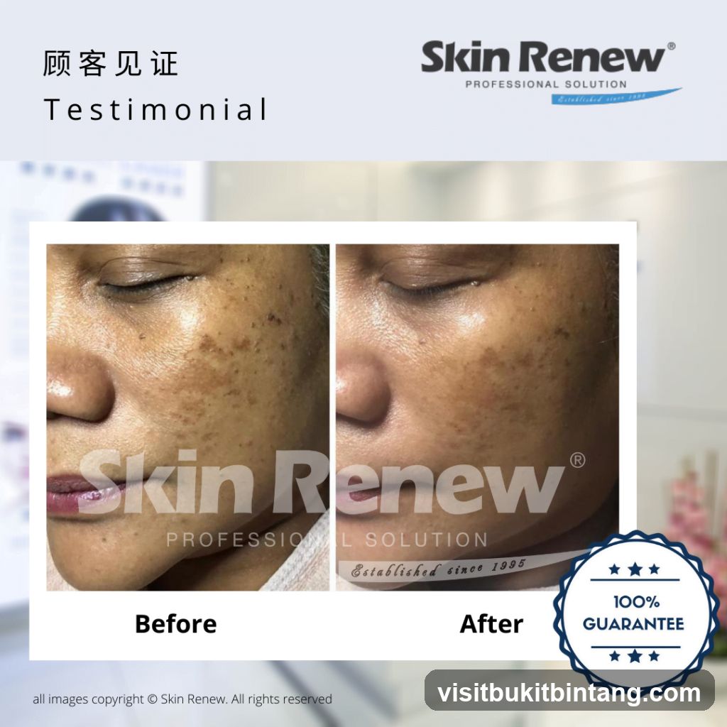Skin Renew Testimonial