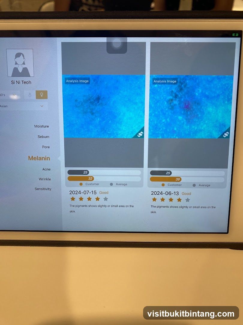 Skin Analysis App Interface