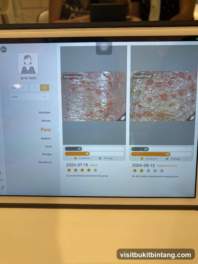 Skin Analysis Device Screen