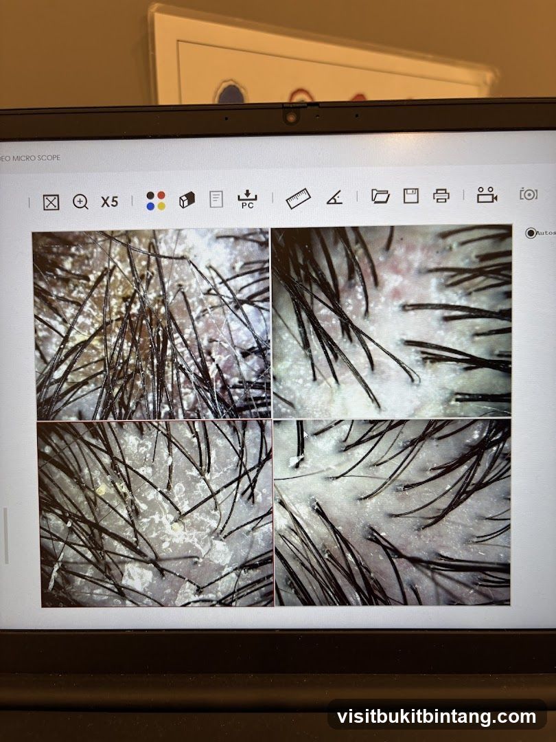 Microscope Images of Hair Follicles