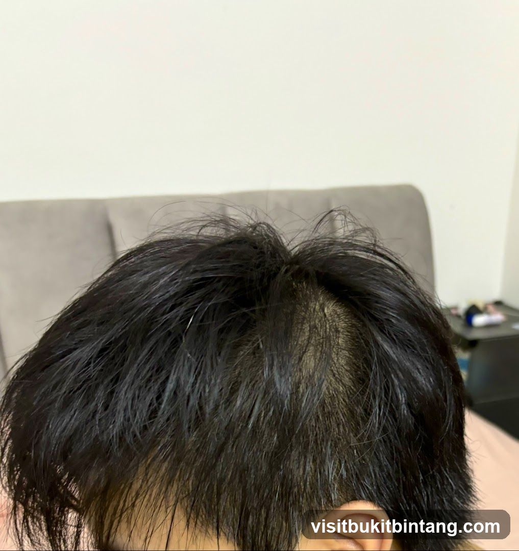 Hairline