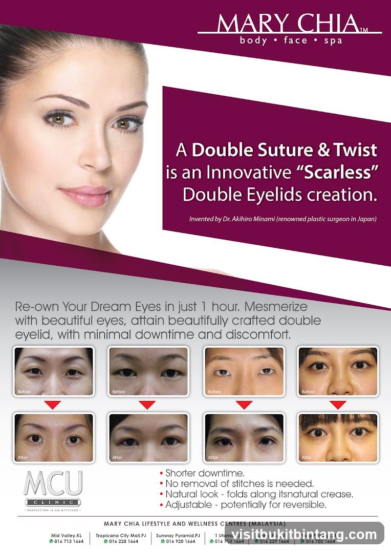Mary Chia Double Eyelids Advertisement