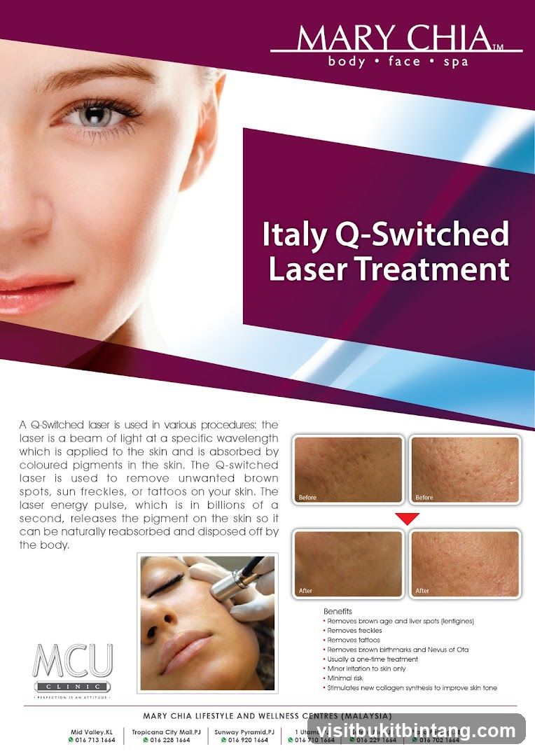 Mary Chia Laser Treatment Advertisement