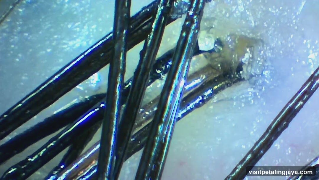 Close-up of hair strands with embedded object