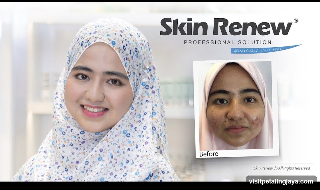 Skin Renew Professional Solution