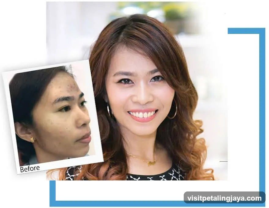 Before and After Transformation
