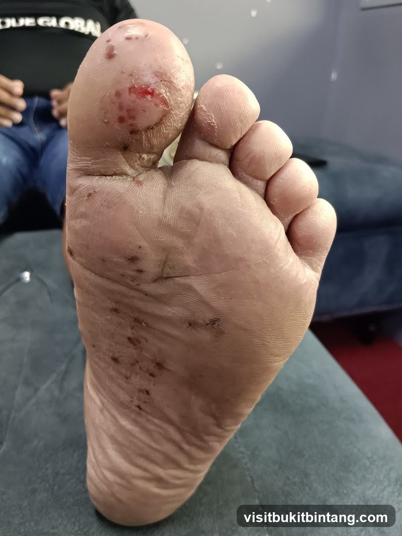 Close-up of a foot with visible abrasions and dirt