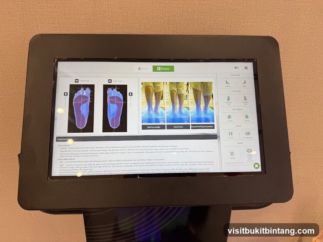 Foot Analysis Screen
