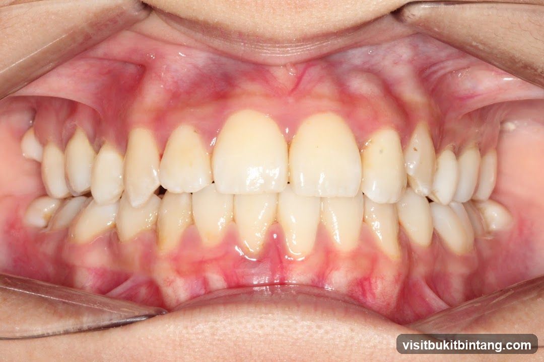 Dental Examination