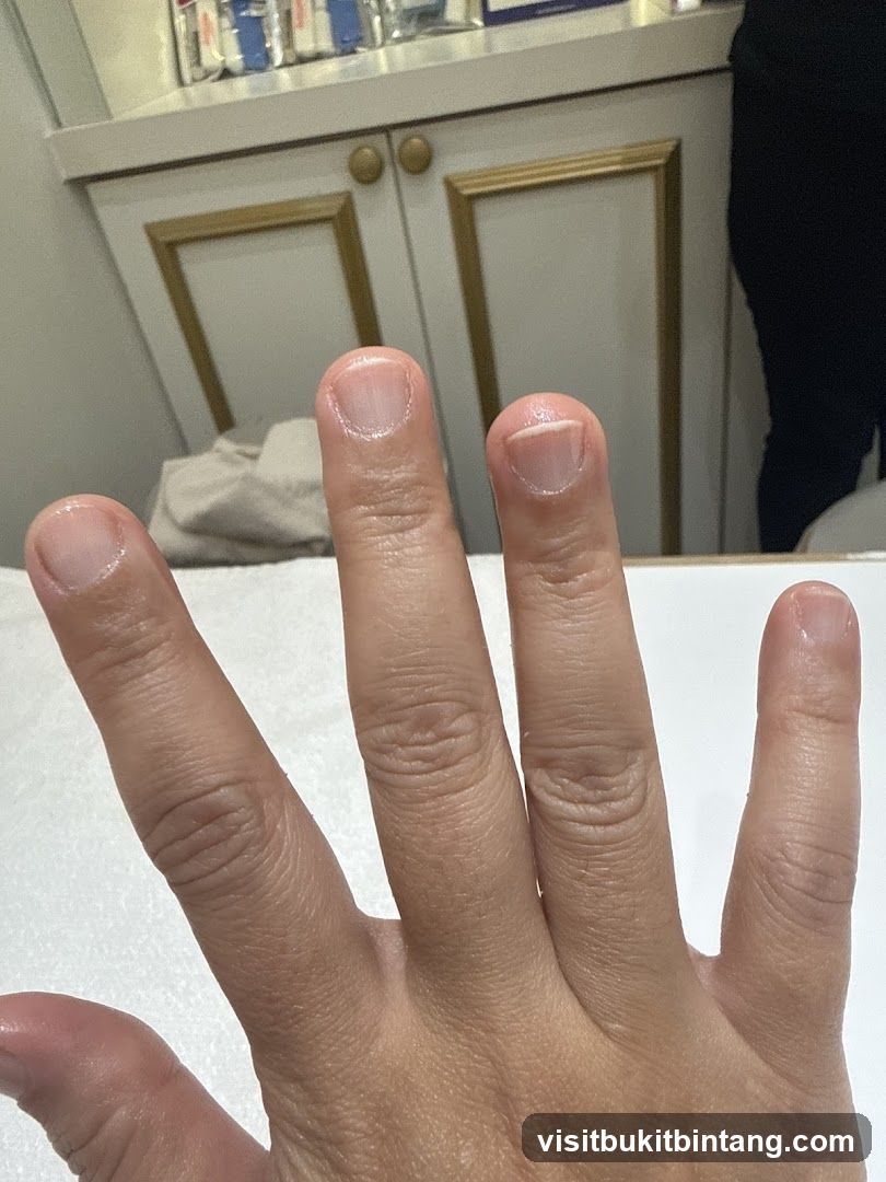 Hand with unpolished nails