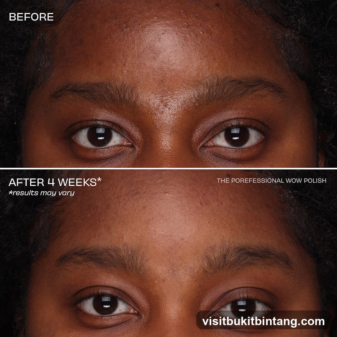 Before and After Comparison of The POREfessional WOW Polish