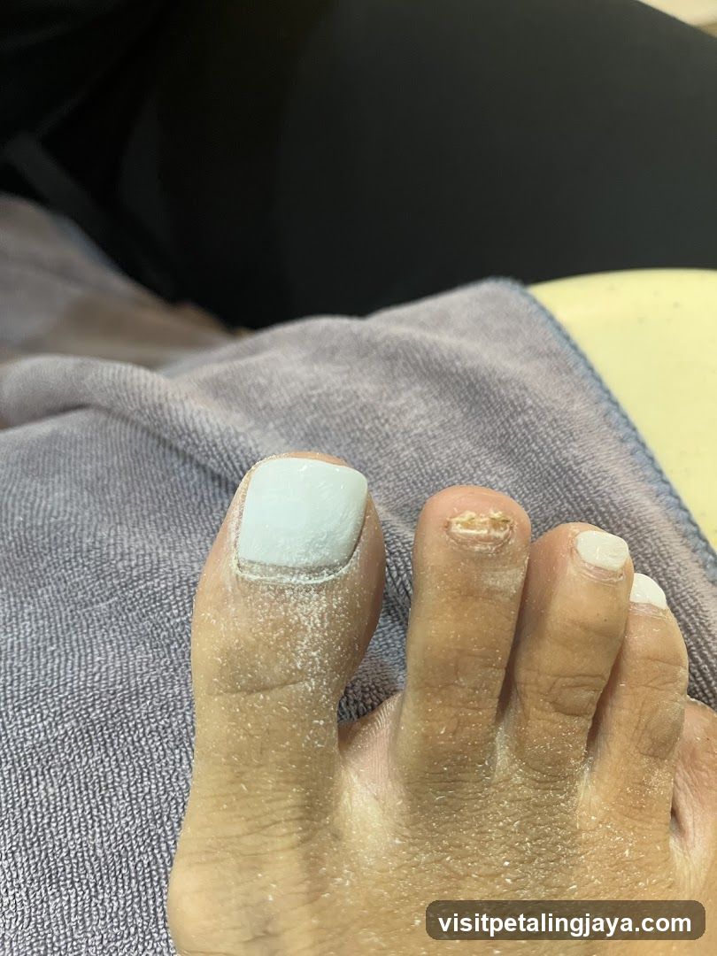 Foot with damaged toenail