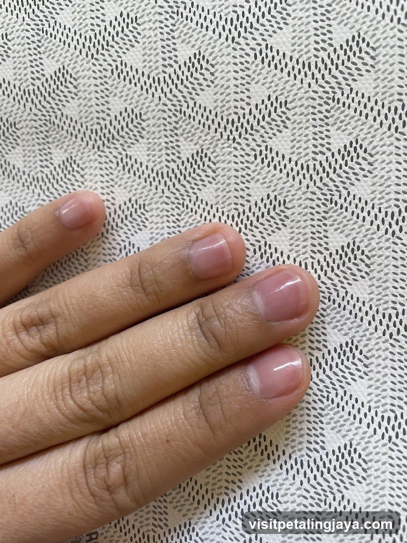 Hand on patterned fabric