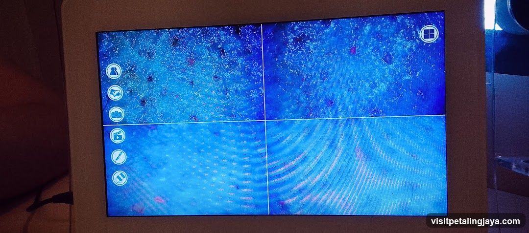 Microscope Screen Display