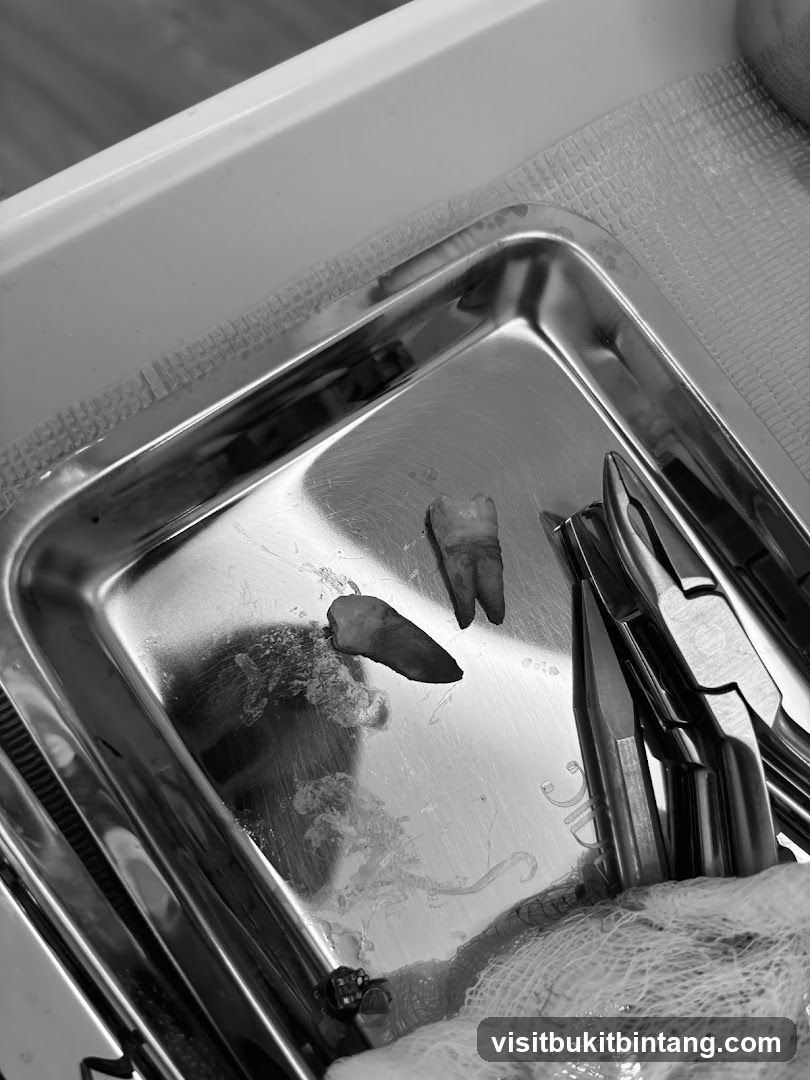 Dental Extraction Tray