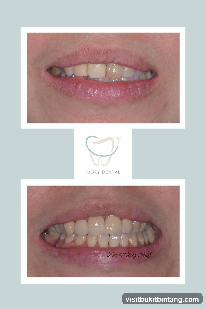 Dental Before and After