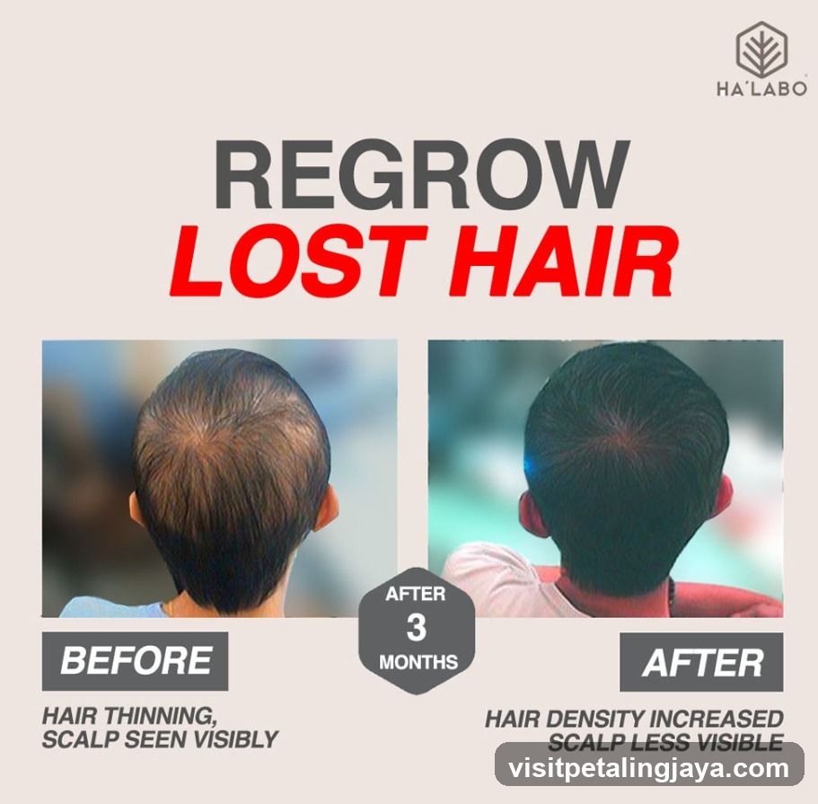 Regrow Lost Hair Ad