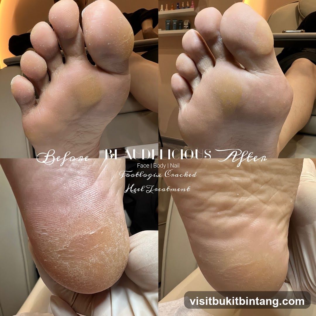 Before and After Foot Treatment
