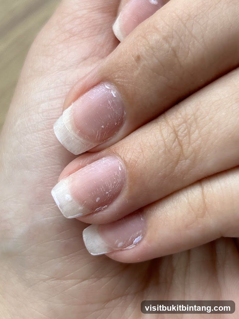 Nails with chipped polish