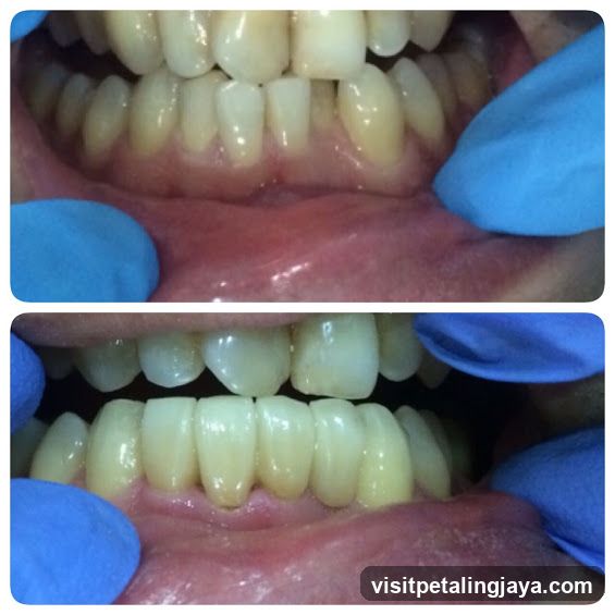 Dental Examination