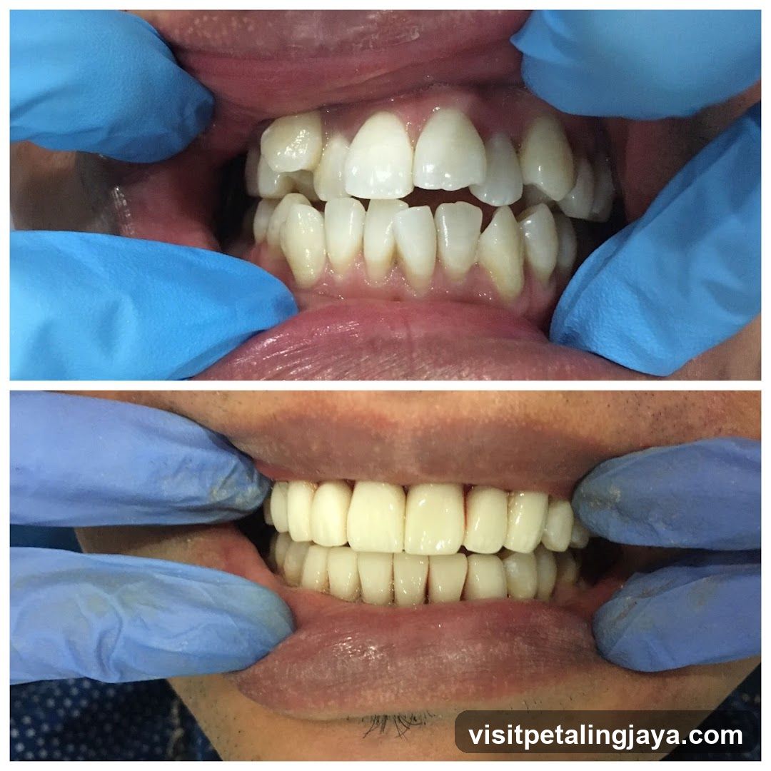 Dental Examination