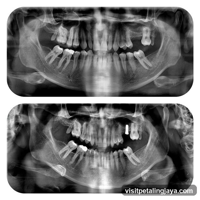 Dental X-ray Panoramic View