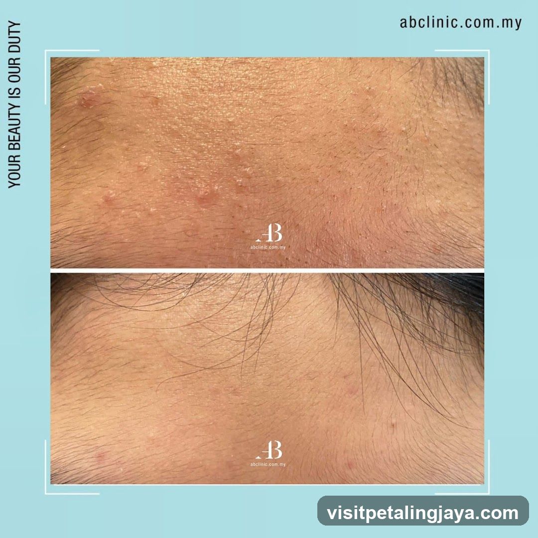 Before and After Skin Treatment Comparison