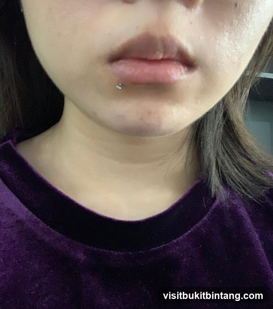 Close-up of a person's lower face and neck