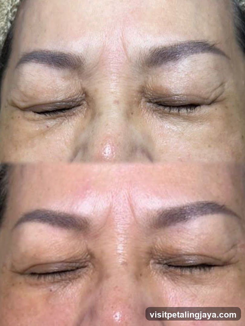 Face Close-Up Comparison