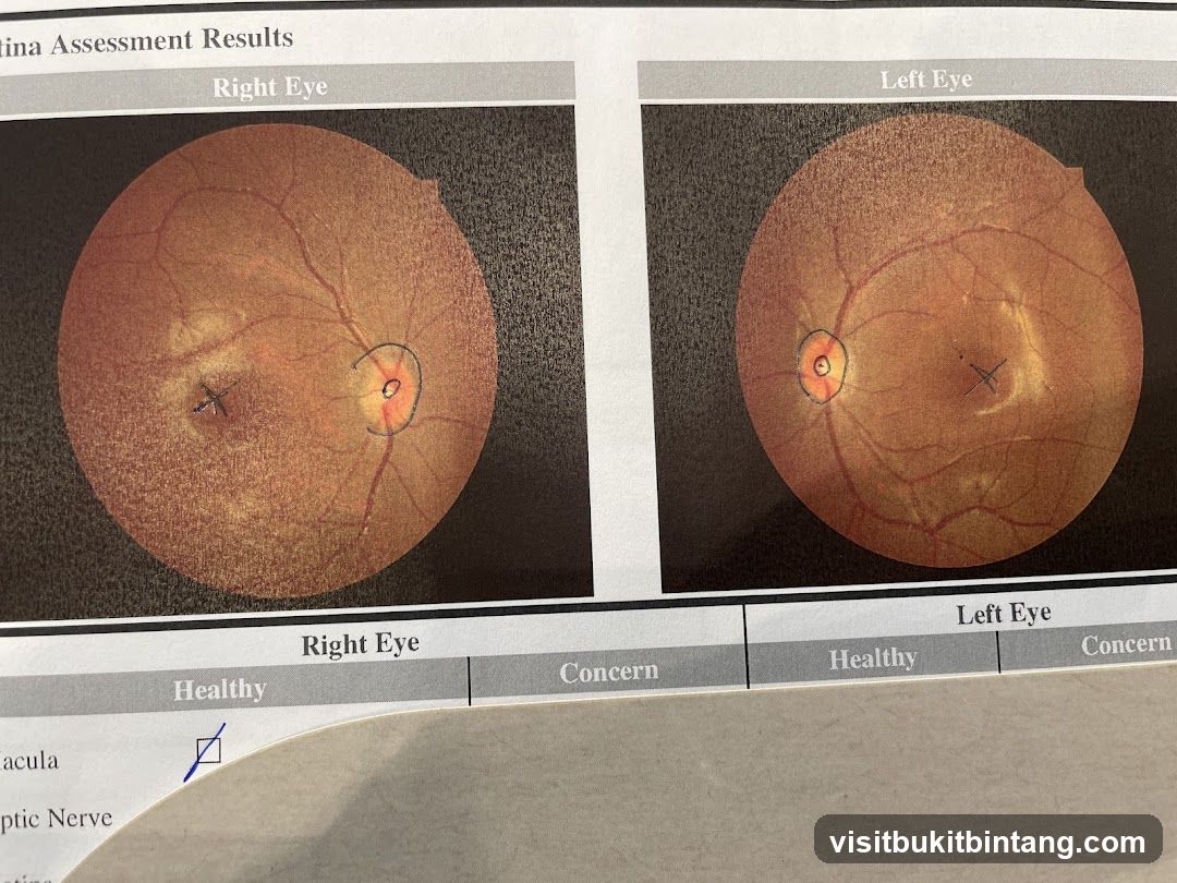Retina Assessment Results