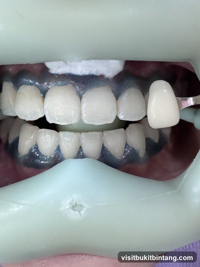Dental Procedure