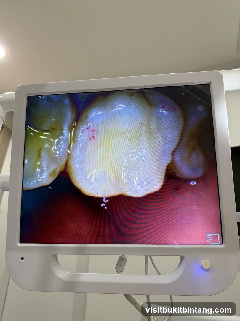 Dental Intraoral Camera Display