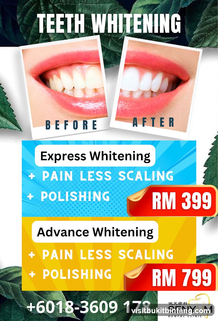Teeth Whitening Promotion