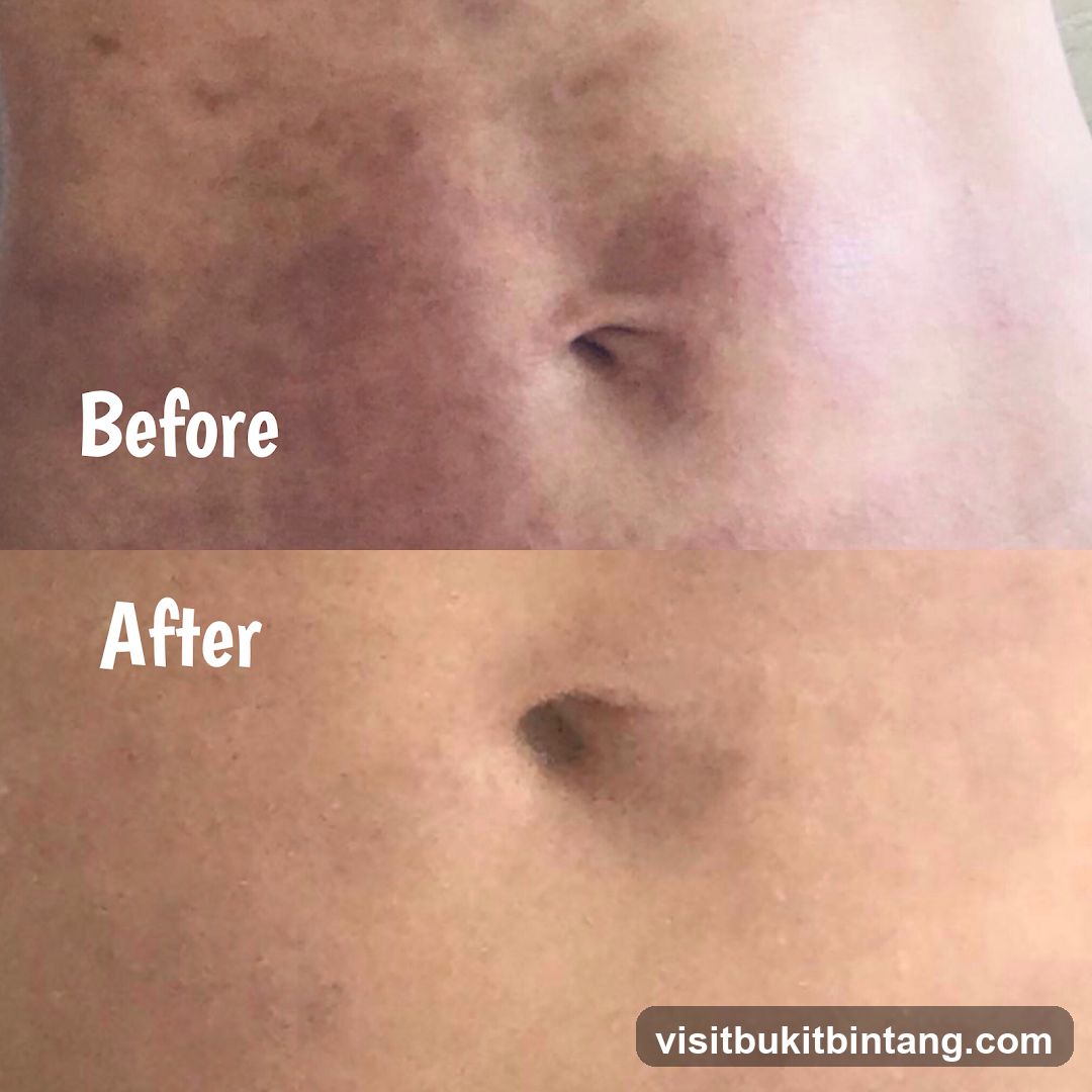 Before and After Belly Button Comparison