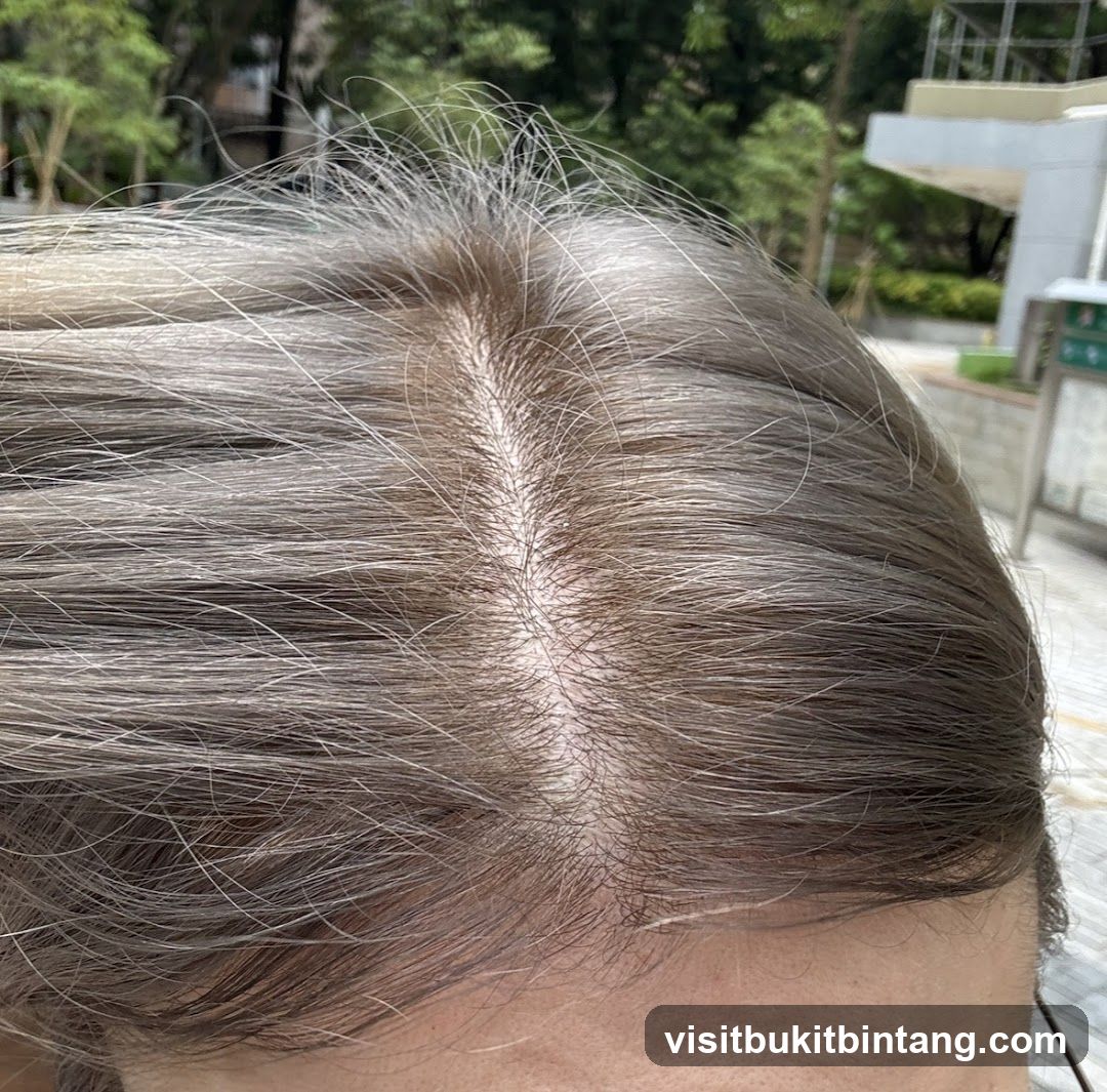 Close-up of a person's scalp and hair