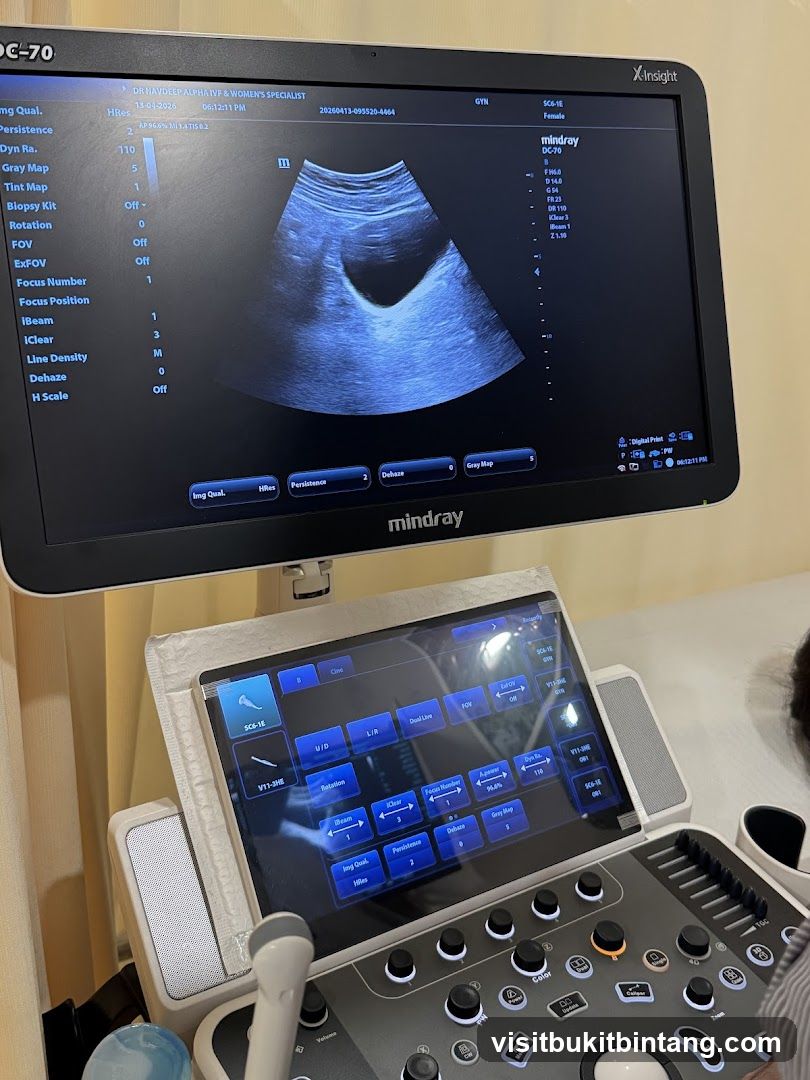 Ultrasound Machine Display