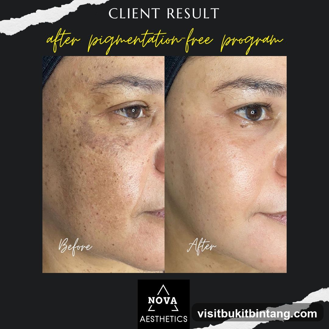 Nova Aesthetics Sunway Giza Kota Damansara