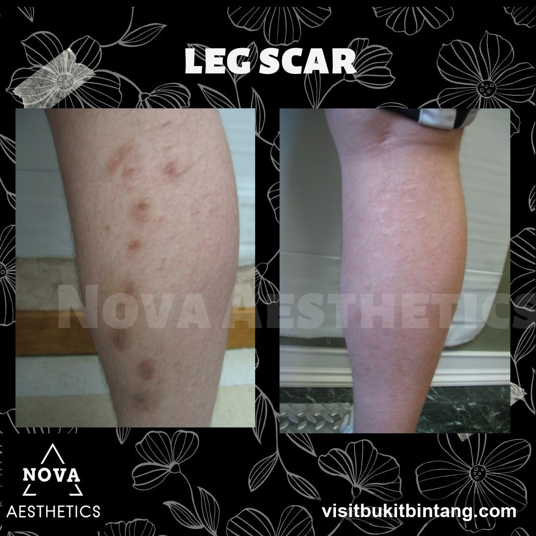 Nova Aesthetics Sunway Giza Kota Damansara