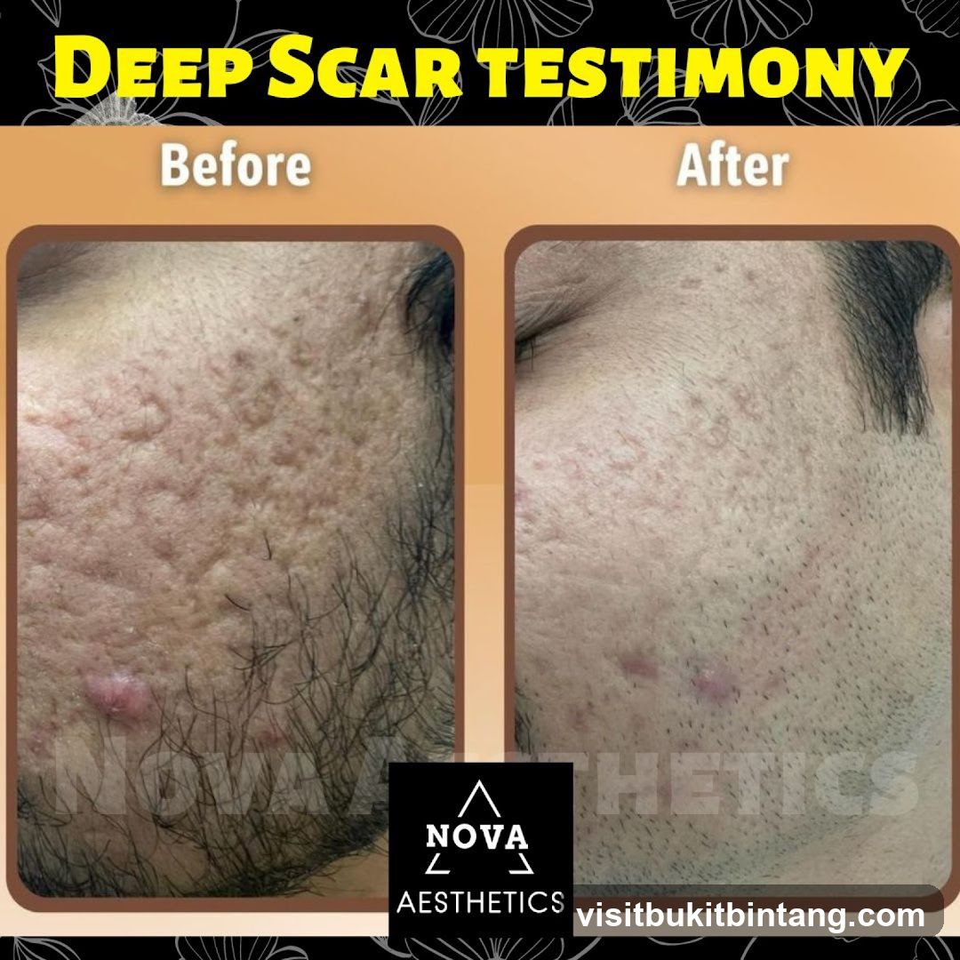 Nova Aesthetics Sunway Giza Kota Damansara