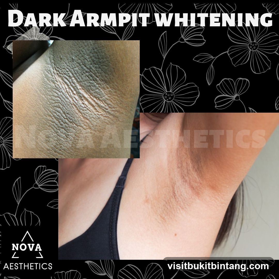 Nova Aesthetics Sunway Giza Kota Damansara