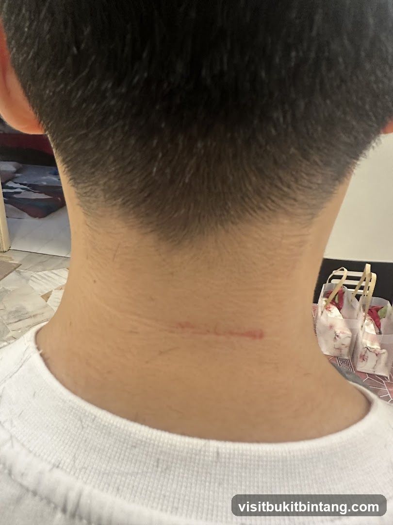 Scar on Neck