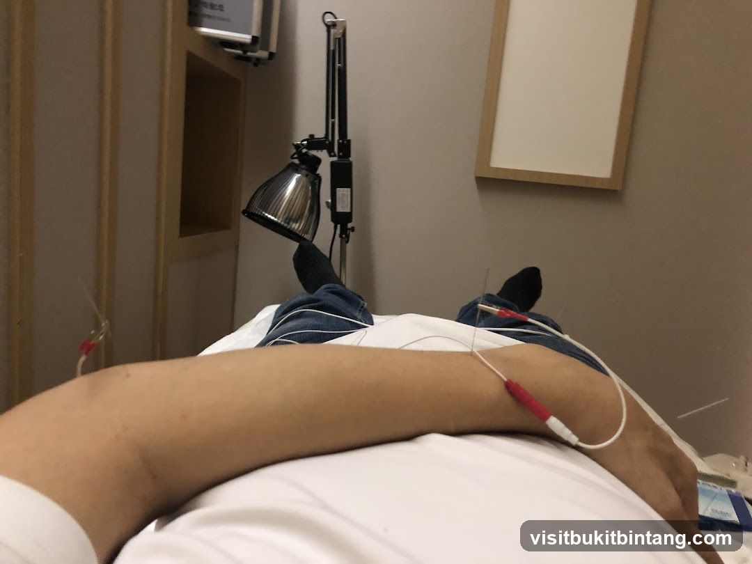 Acupuncture treatment