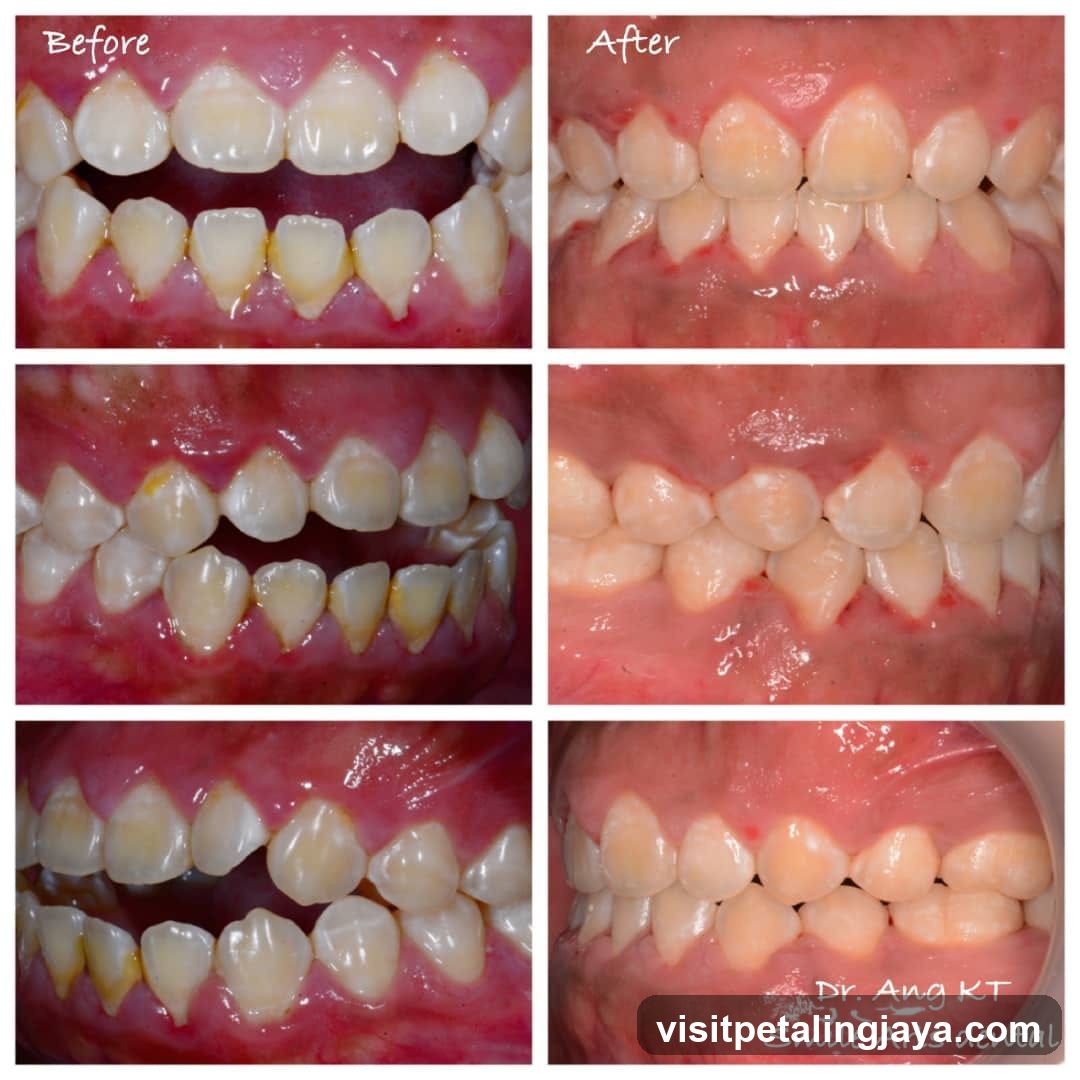 Dental Treatment Before and After Comparison