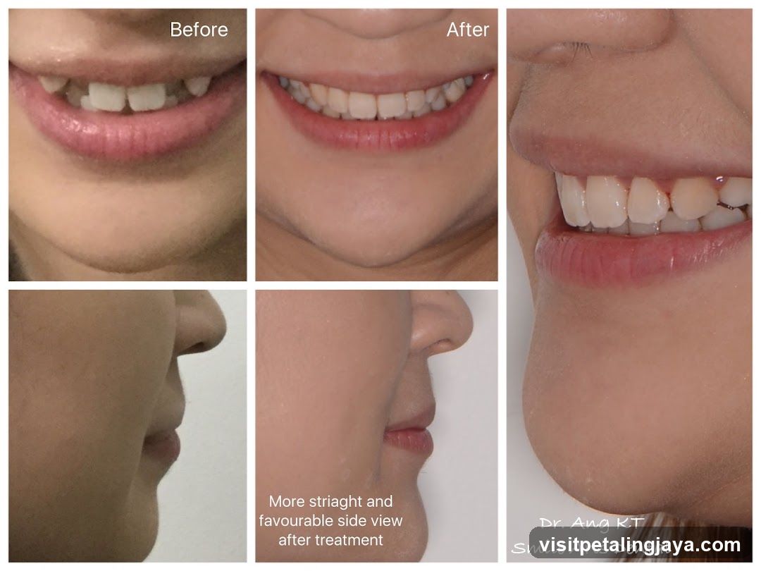 Dental Treatment Before and After Comparison